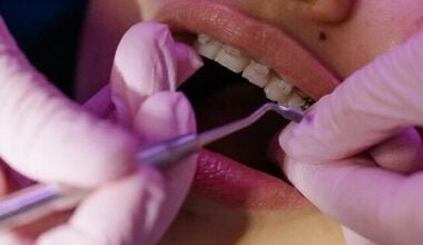 Best Dental Hygienist Schools in New York