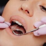 Trade Schools For Dental Hygienist